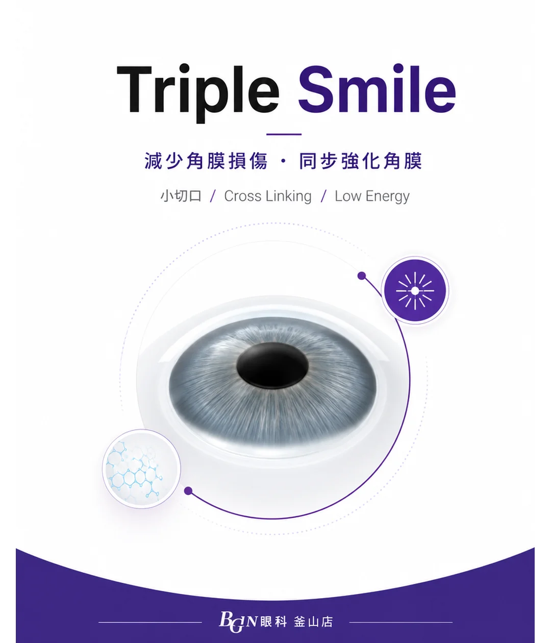 Triple SMILE 三重全飛秒近視矯正主視覺